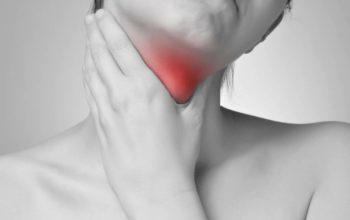 Hypothyroidism