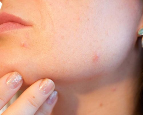 Affect Skin Health