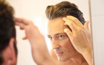 Hair Loss and Your Hormones