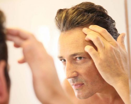 Hormones for Hair Loss