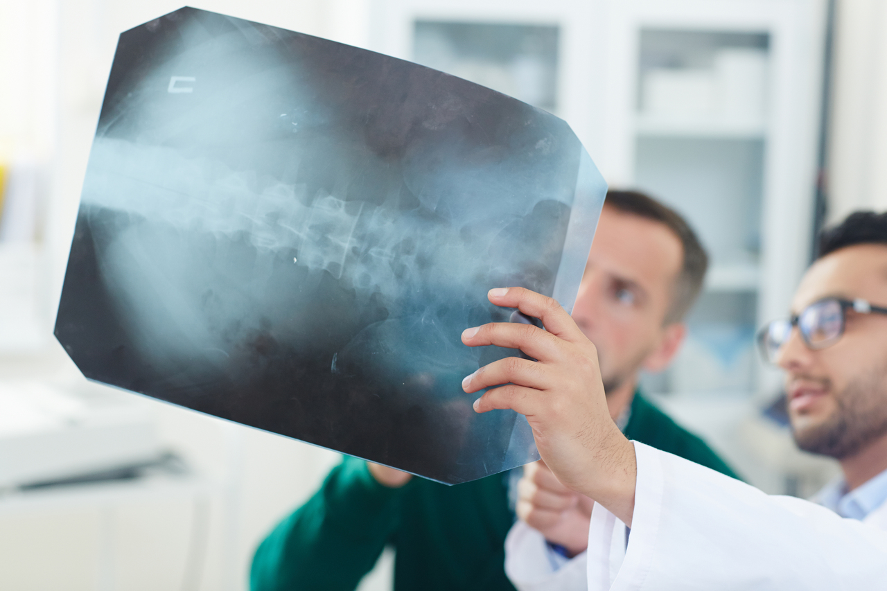 A doctor holding up a spinal x-ray