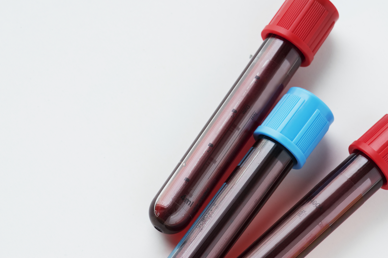 Blood tube test for cholesterol