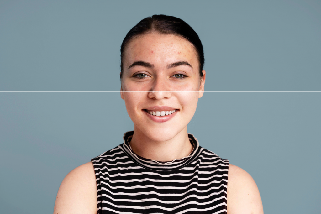 Transformation from Aging to Radiant: An image of a woman gently peeling away aged skin to unveil a rejuvenated and healthy complexion beneath.